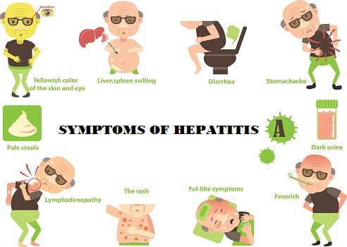 Hepatitis symptoms
