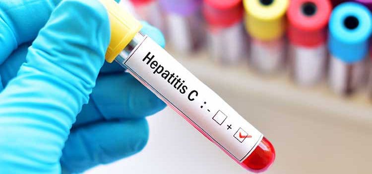 Treatment Options If You Are Diagnosed With Hepatitis